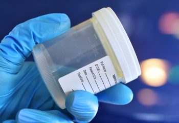 Medical personnel doctor nurse holding urine, semen or stool specimen cup for sample to be tested.